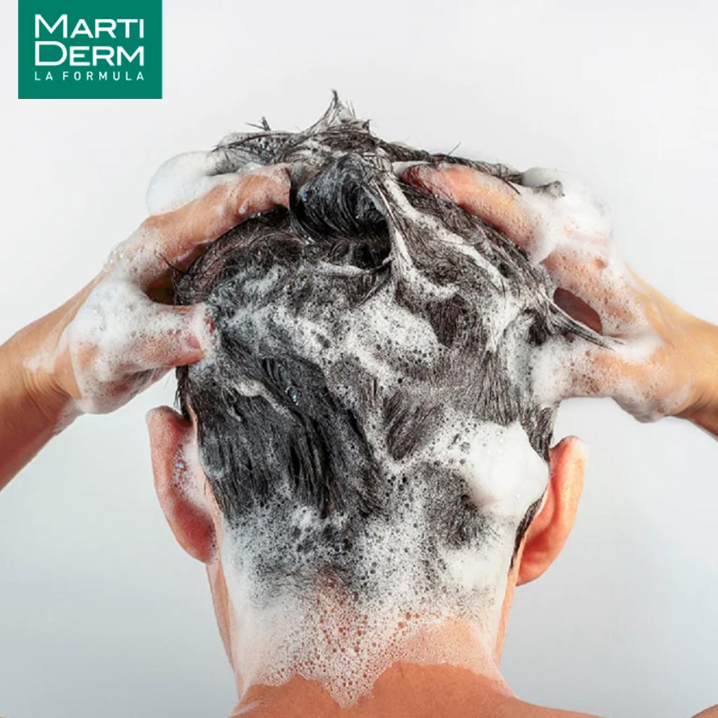 Marti Derm Hair System Antisebum Anti-Hair Loss Shampoo 200ml - Easy Pharmacy LLC