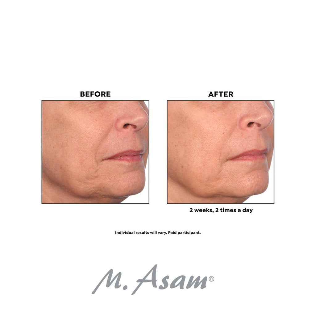 M. Asam Retinol Intense Retinol 1% Treatment Ampoule 1ml, Pack of 14's - Easy Pharmacy LLC