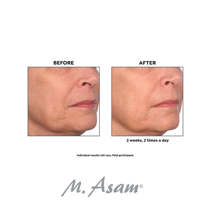 M. Asam Retinol Intense Retinol 1% Treatment Ampoule 1ml, Pack of 14's - Easy Pharmacy LLC