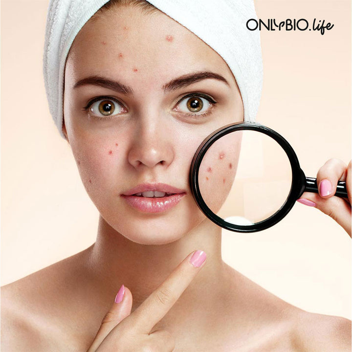 OnlyBio Botanic Clinic Acne Treatment Micro-Exfoliating Night Cream For Blemish Prone Skin 50ml - Easy Pharmacy LLC