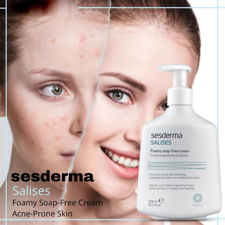 Sesderma Salises Foamy Soap Free Cream For Oily Skin 300ml - Easy Pharmacy LLC
