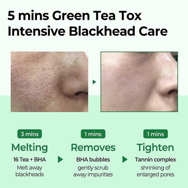 Some By Mi Bye Bye Blackhead 30 Days Miracle Green Tea Tox Bubble Cleanser 120g - Easy Pharmacy LLC
