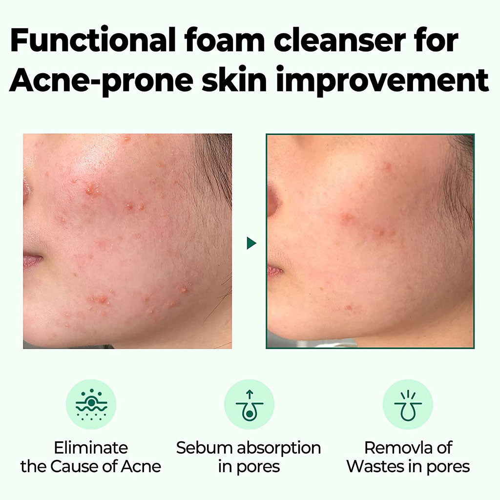 Some By Mi AHA-BHA-PHA 30 Days Miracle Acne Clear Foam Cleanser 100ml - Easy Pharmacy LLC