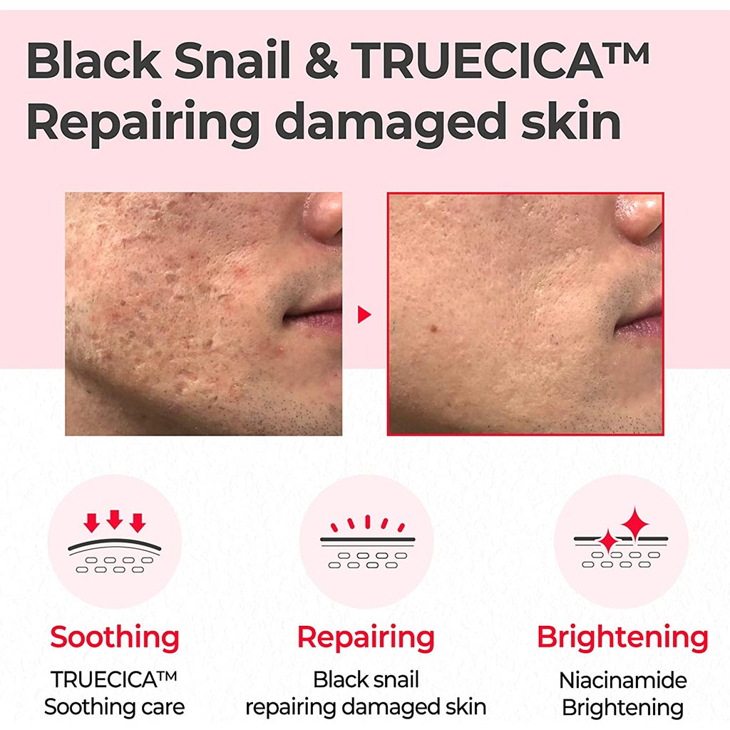 Some By Mi Snail Truecica Miracle Repair Face Toner 135ml - Easy Pharmacy LLC