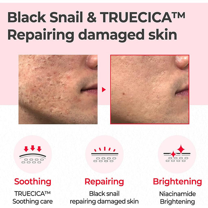 Some By Mi Snail Truecica Miracle Repair Face Toner 135ml - Easy Pharmacy LLC