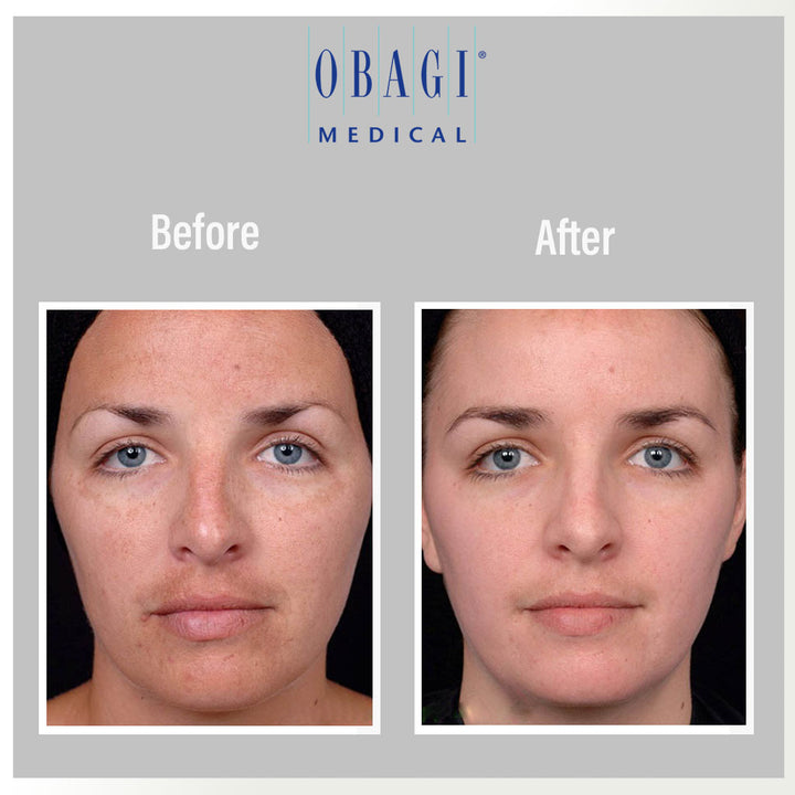 Obagi - C Fx C -Clarifying Skin Brightening Facial Serum With Vitamin C 30ml - Easy Pharmacy LLC