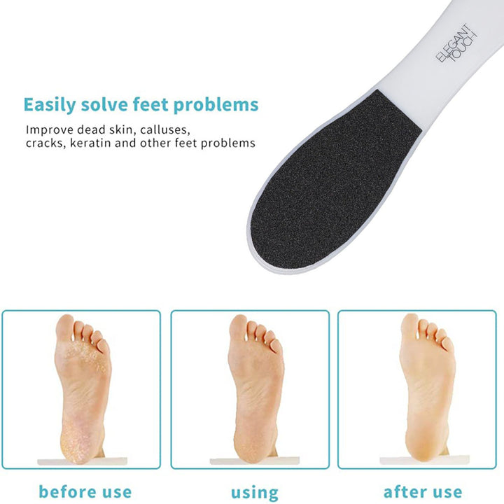 Elegant Touch Pedicure Foot File - Black And White, Pack of 1's - Easy Pharmacy LLC