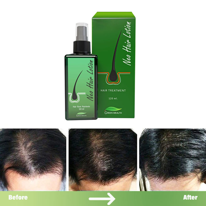 Green Wealth Neo Hair Lotion For Hair Growth 120ml - Easy Pharmacy LLC