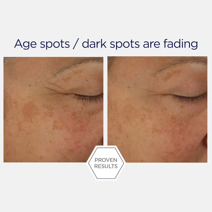 Neostrata Skin Active Firming Potent Retinol Complex Night Serum 30ml - Easy Pharmacy LLC