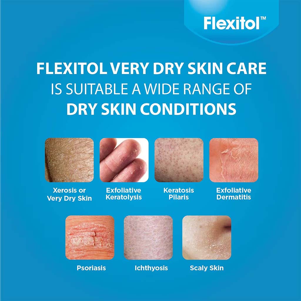 Flexitol Very Dry Skin Lotion For Very Dry Itchy Skin Relief 500ml - Easy Pharmacy LLC