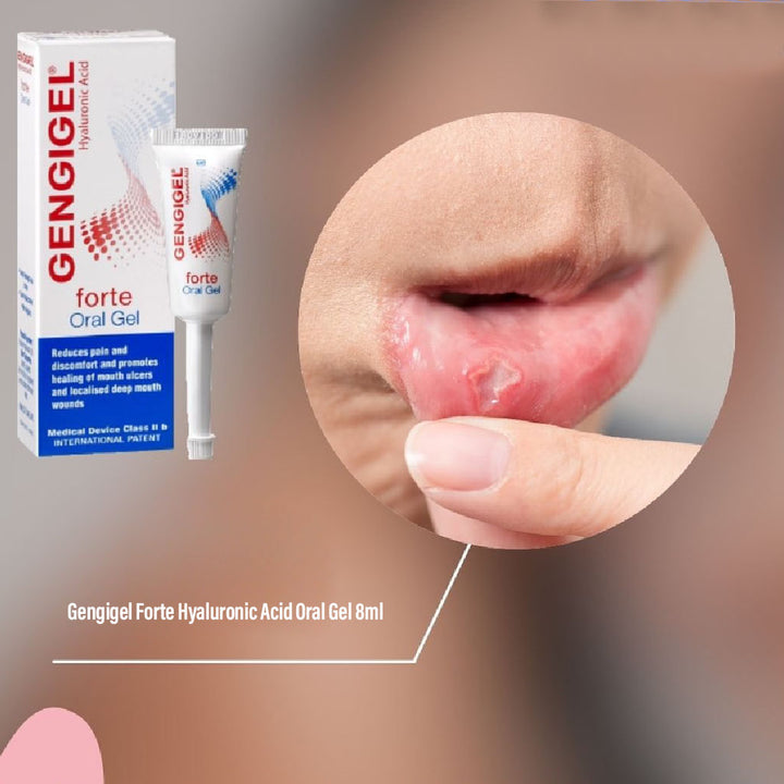 Gengigel Forte Hyaluronic Acid Oral Gel, Pain Relieving Oral Gel For Mouth Ulcers & Mouth Wounds 8ml - Easy Pharmacy LLC