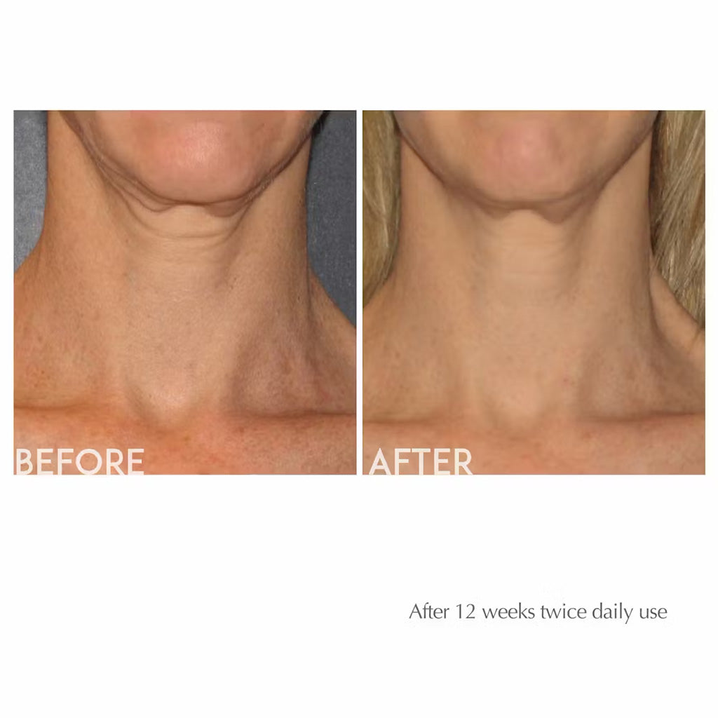 Exuviance Age Reverse Anti-Aging Toning Neck Cream 125g - Easy Pharmacy LLC
