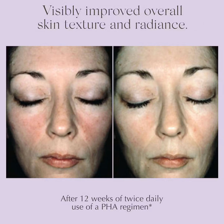Exuviance Overnight Hydrating Transformation Complex Anti-Aging Night Cream For Sensitive, Dry Skin Types 50g - Easy Pharmacy LLC