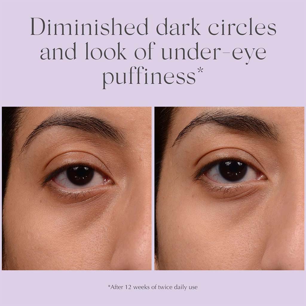 Exuviance Bright Eyes Dark Circle Corrector Brightening Eye Cream 15g - Easy Pharmacy LLC