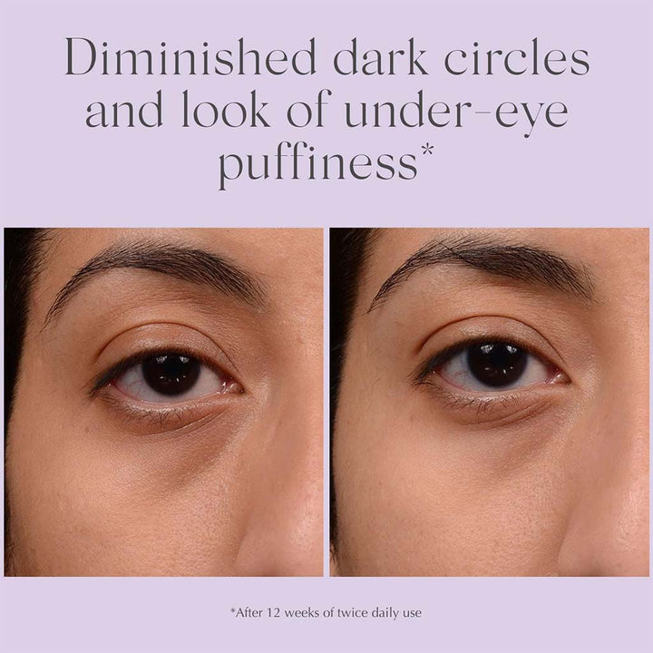 Exuviance Bright Eyes Dark Circle Corrector Brightening Eye Cream 15g - Easy Pharmacy LLC