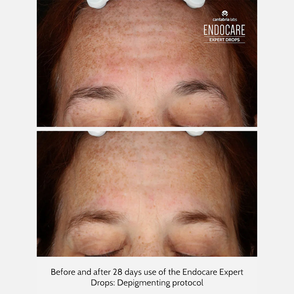 Endocare Expert Drops Day And Night Depigmenting Protocol 10ml, Pack of 2's - Easy Pharmacy LLC