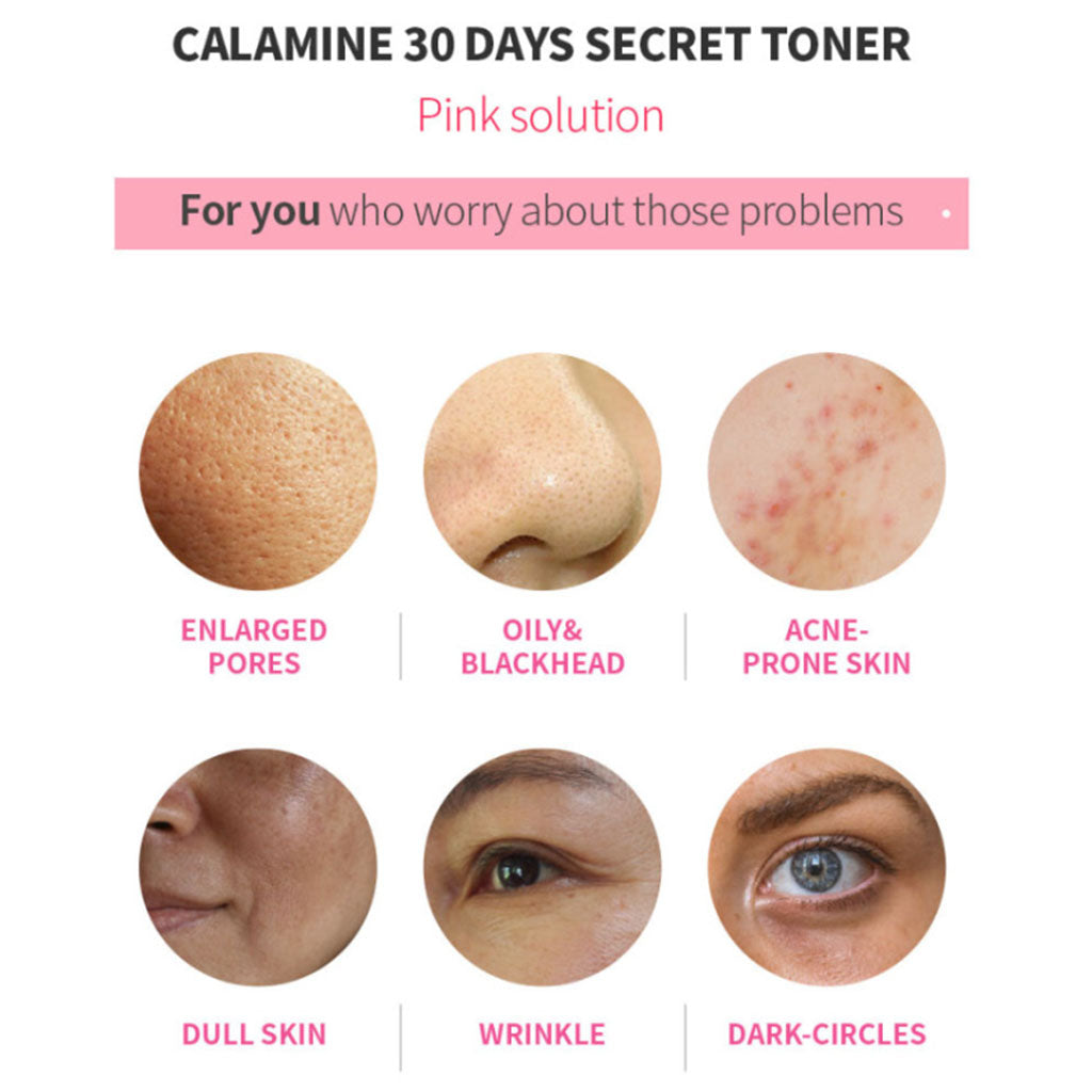 K-Secret Calamine 30 Days Secret Toner For Sensitive Skin 160ml - Easy Pharmacy LLC