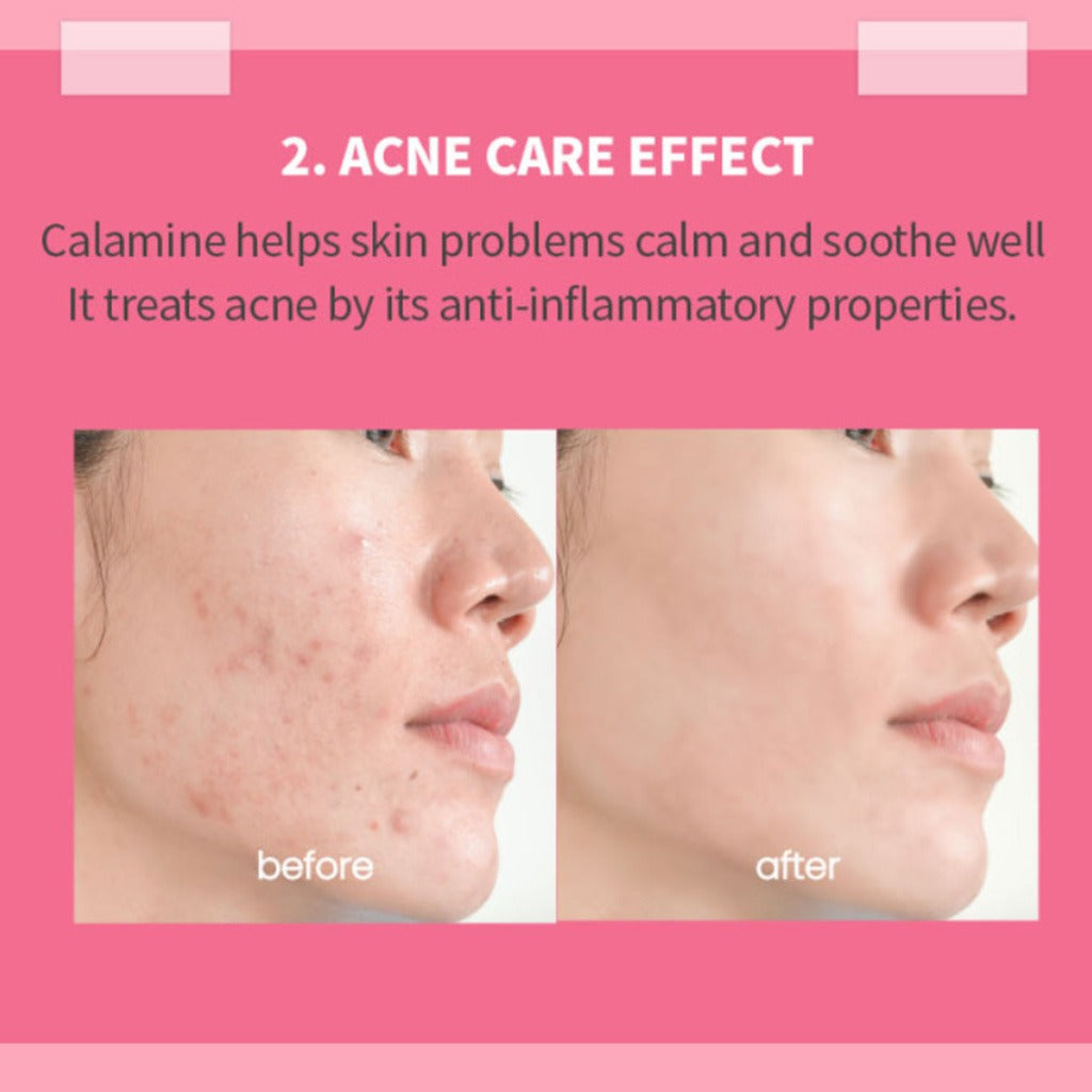 K-Secret Calamine 30 Days Secret Toner For Sensitive Skin 160ml - Easy Pharmacy LLC