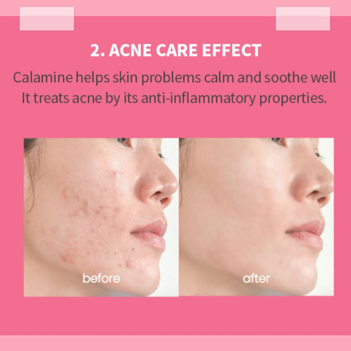 K-Secret Calamine 30 Days Secret Toner For Sensitive Skin 160ml - Easy Pharmacy LLC