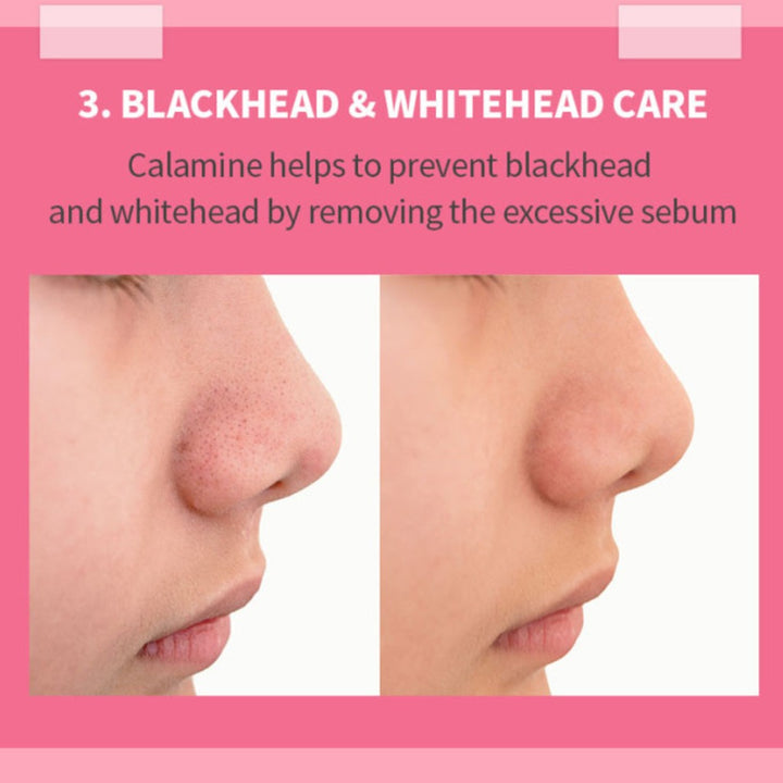 K-Secret Calamine 30 Days Secret Toner For Sensitive Skin 160ml - Easy Pharmacy LLC