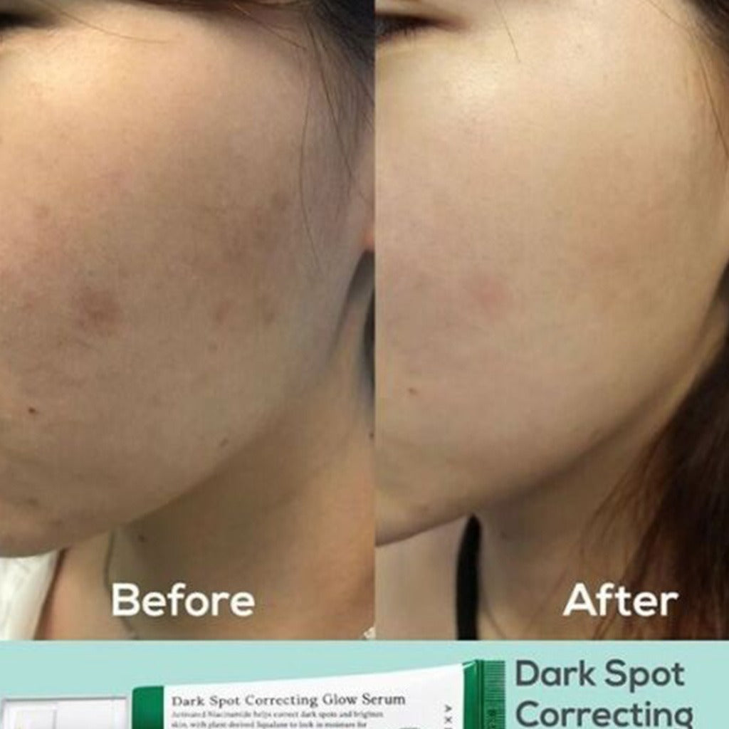 Axis-Y Dark Spot Correcting Brighten + Moisturize Glow Facial Serum 50ml - Easy Pharmacy LLC