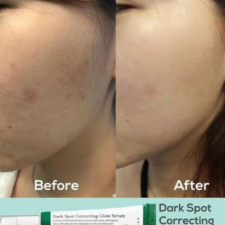 Axis-Y Dark Spot Correcting Brighten + Moisturize Glow Facial Serum 50ml - Easy Pharmacy LLC
