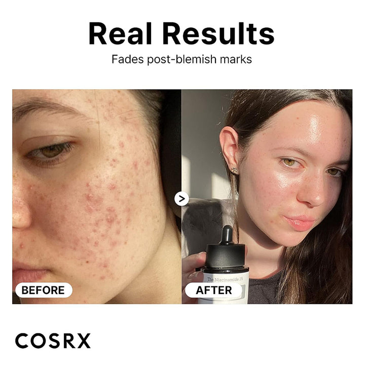 Cosrx The Niacinamide 15 Oil Control Acne Care Facial Serum 20ml - Easy Pharmacy LLC