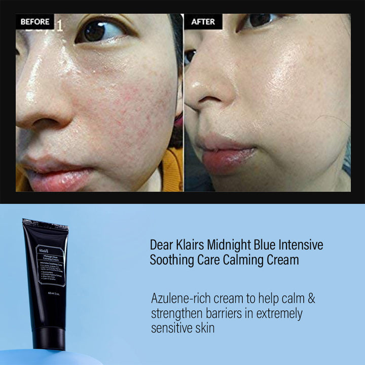 Dear Klairs Midnight Blue Intensive Soothing Care Calming Cream 60ml - Easy Pharmacy LLC