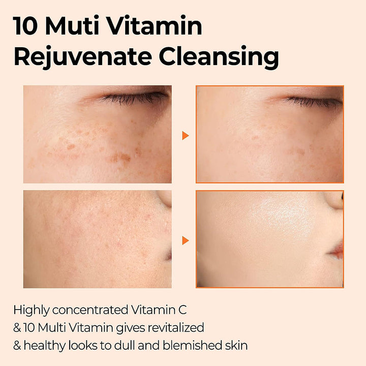 Some By Mi Pure Vitamin C V10 Multi Vita Brightening Cleansing Bar 95g - Easy Pharmacy LLC
