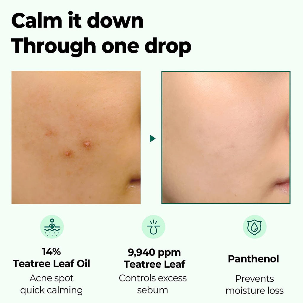 Some By Mi 30 Days Miracle Tea Tree Clear Spot Facial Oil 10ml - Easy Pharmacy LLC