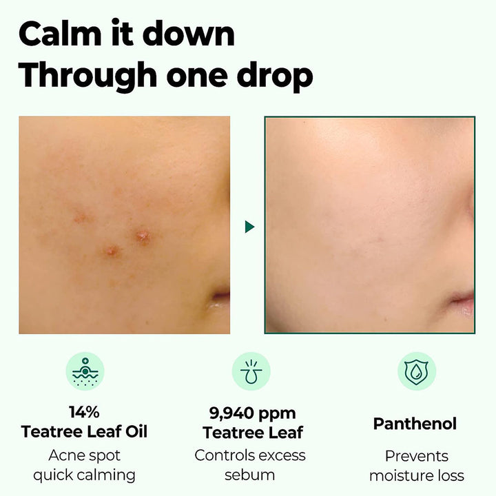 Some By Mi 30 Days Miracle Tea Tree Clear Spot Facial Oil 10ml - Easy Pharmacy LLC