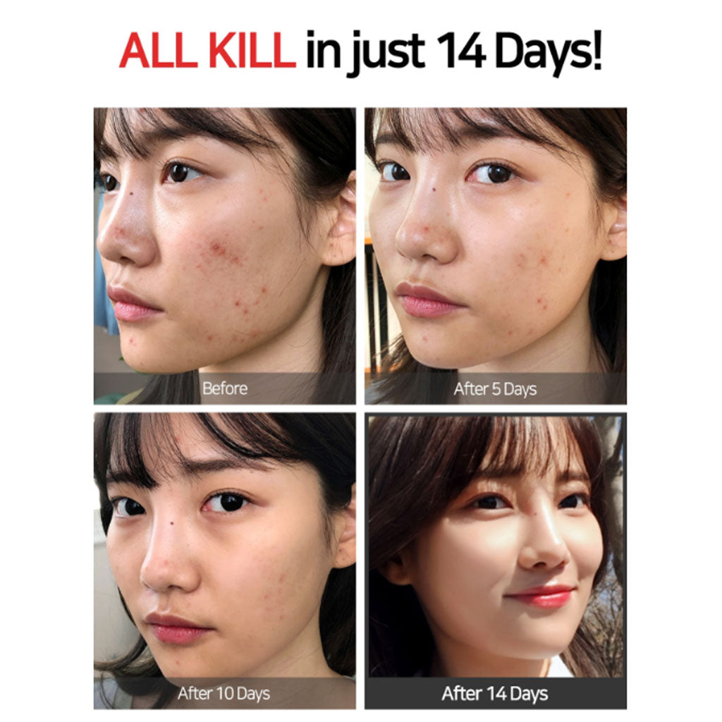 Some By Mi AHA BHA PHA 14 Days Super Miracle Spot All Kill Cream 30ml - Easy Pharmacy LLC