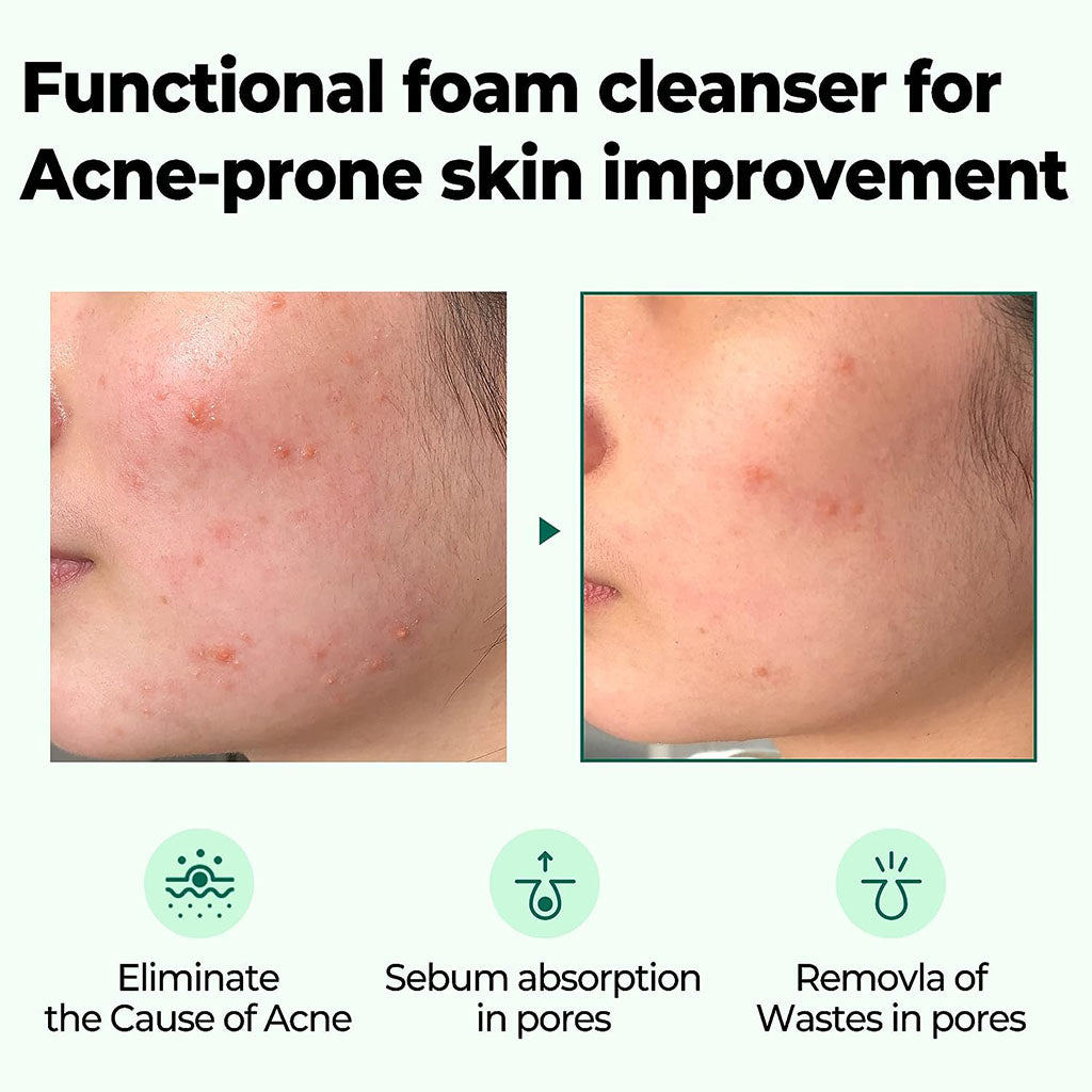 Some By Mi AHA BHA PHA 30 Days Miracle Acne Clear Foam Cleanser For Acne-Prone Skin 100ml - Easy Pharmacy LLC