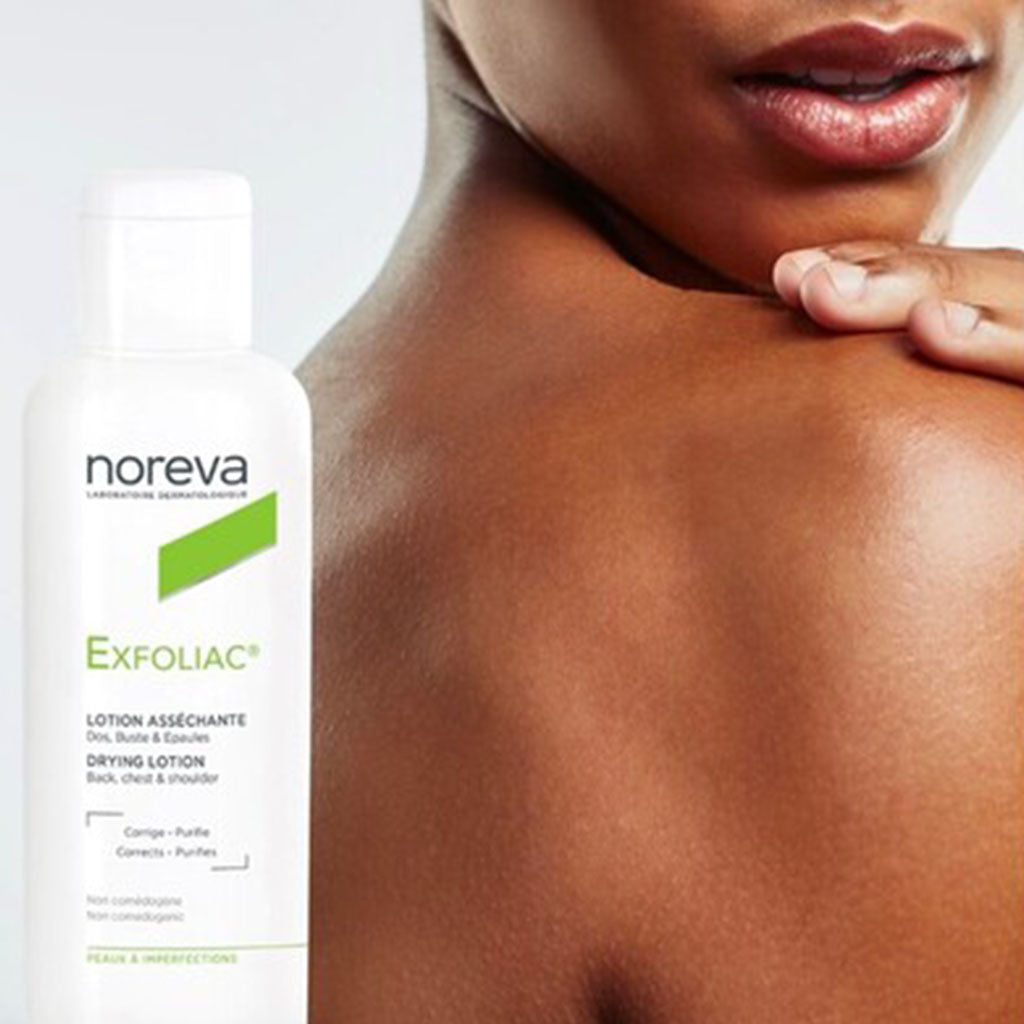 Noreva Exfoliac Drying Lotion For Face, Back, Chest, & Shoulder 125ml - Easy Pharmacy LLC