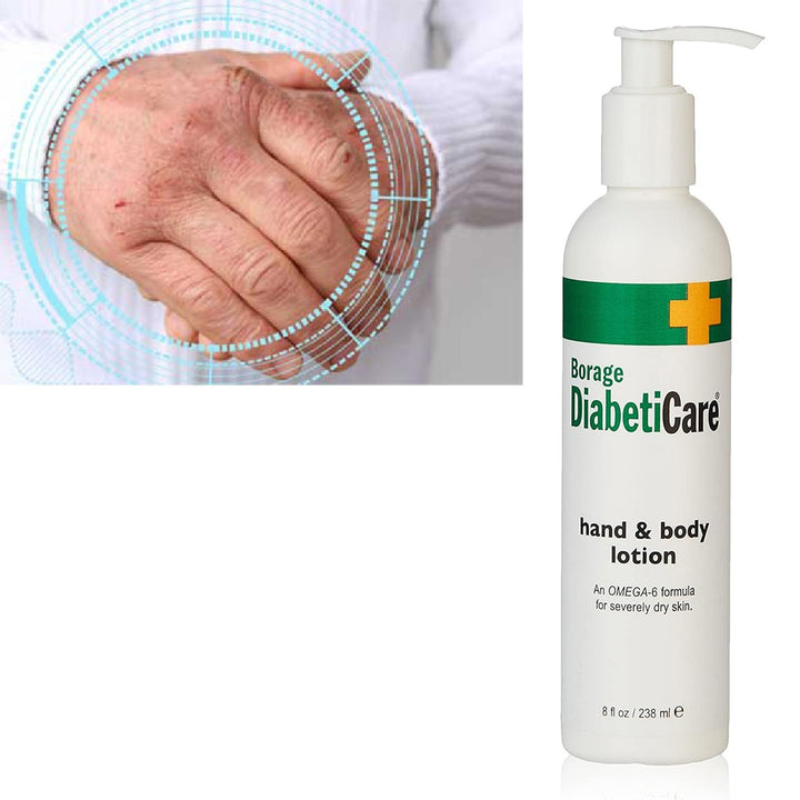 ShiKai Borage DiabetiCare Omega-6 Hand & Body Lotion For Dry Skin 238ml - Easy Pharmacy LLC