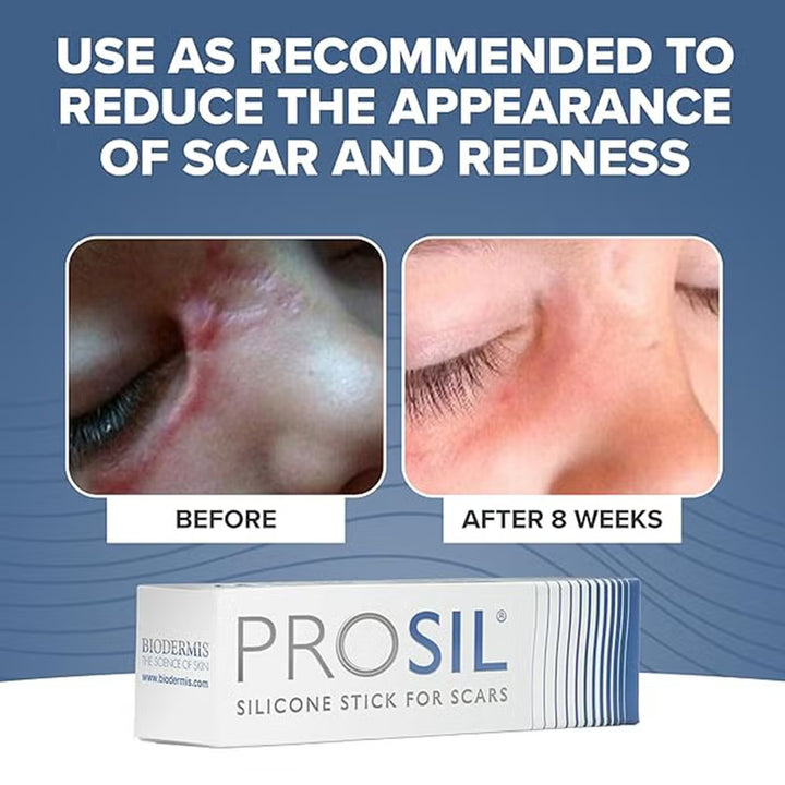 Biodermis Prosil Silicone Scar Stick 4.25 g For Scars